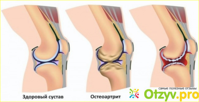 Инструкция по применению