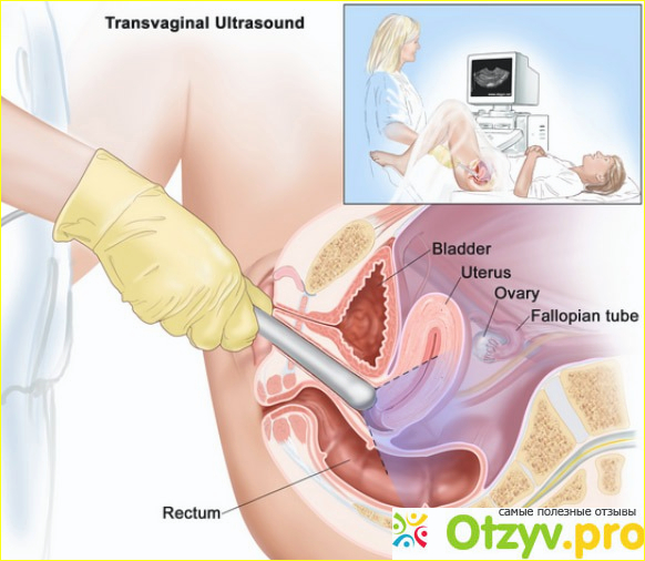 Ультразвуковое обследование матки