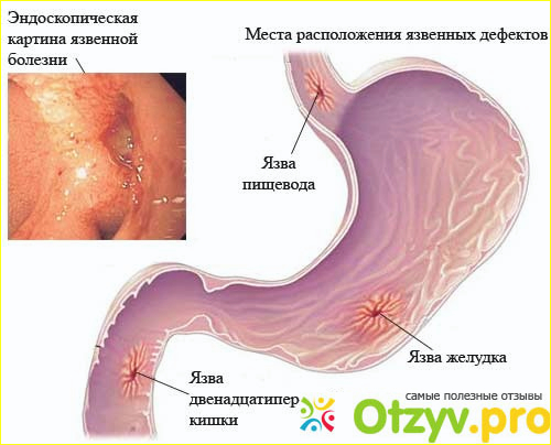 Почему она появляется?