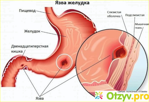 Лечение после операции 