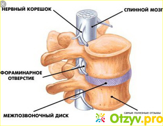 Отзыв о Парез конечностей