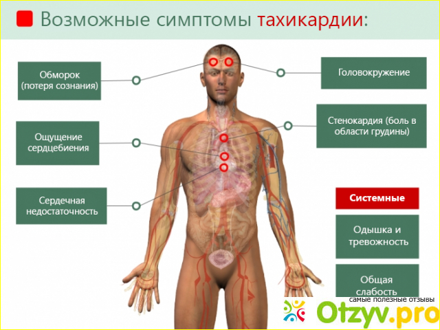 Отзыв о Приступ тахикардии симптомы