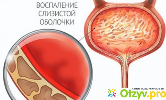 Отзыв о Почему больно писать девушке