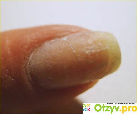 Однозначно рекомендую Zinger nail repair