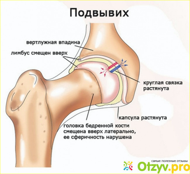 Плазмолифтинг является одним из способов лечения суставов