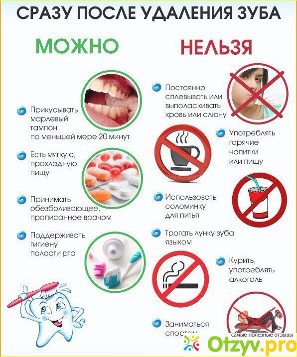 Опытный стоматолог обязательно вам расскажет про уход за полостью рта после удаления зуба