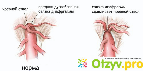 Основные характеристики, лечение.