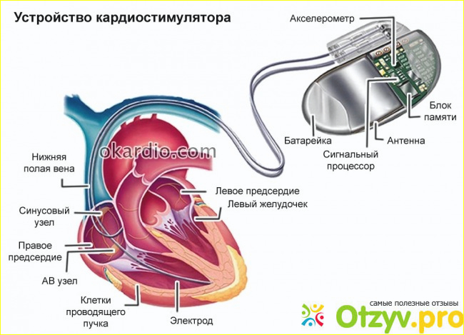 Инструкция для пациентов