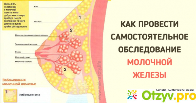 Отзыв о Как обследовать грудную железу самостоятельно
