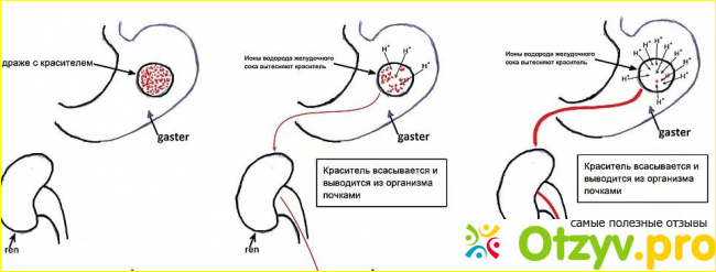 Отзыв о Гастрит с повышенной и пониженной кислотностью как отличить