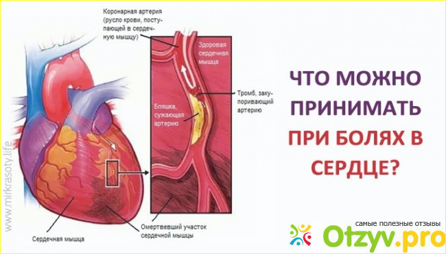 Что необходимо предпринять для устранения боли в сердце