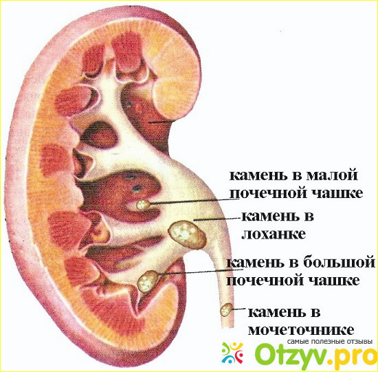 Холит инструкция по применению цена отзывы аналоги фото1