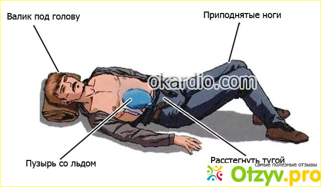  Действия до приезда скорой помощи.