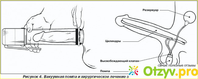 Вред помпы для мужского организма