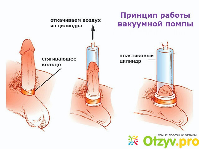 Как увеличить потенцию без помощи таблеток?