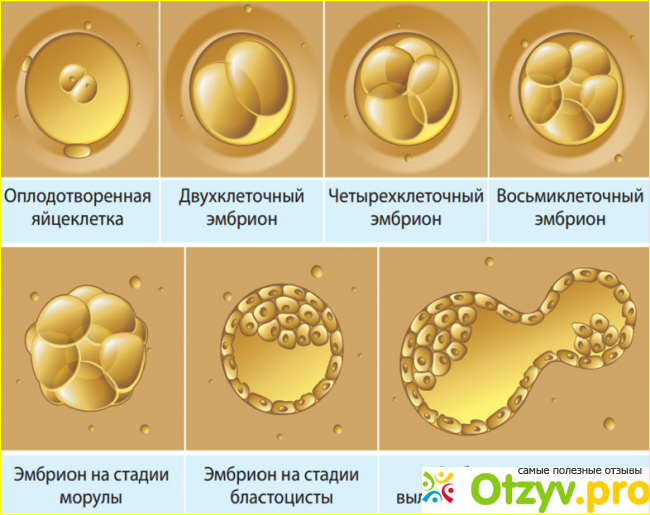 Кому показано экстракорпоральное оплодотворение