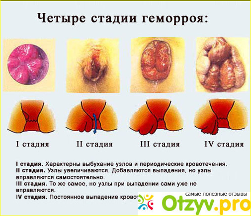 Как подготовить себя к осмотру врача