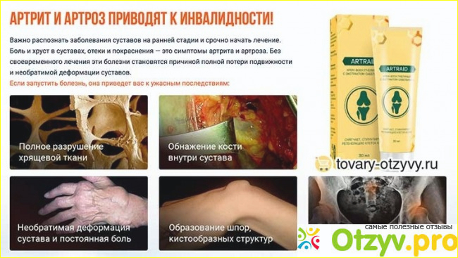 Крем суставов никогда не лечит!