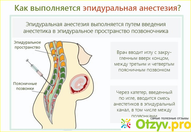  впечатления от процедуры 