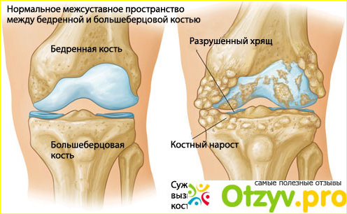 Найзилат цена и где купить