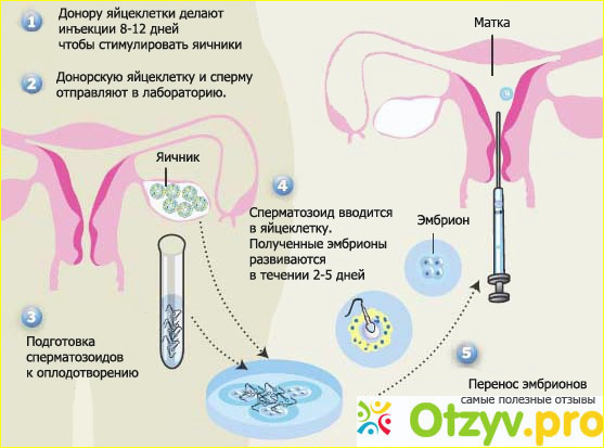 Отзыв о Последствия после эко для организма женщины отзывы