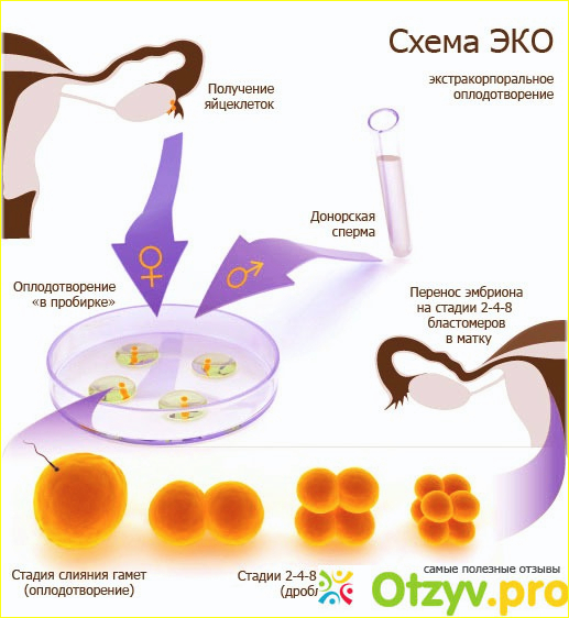 Подготовка к экстракорпоральному оплодотворению. 