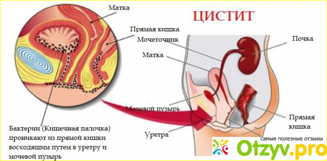 Препараты растительного происхождения