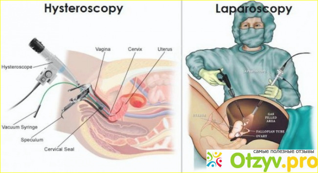 Гистероскопия в спб отзывы фото1