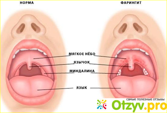 Супракс цена и где купить