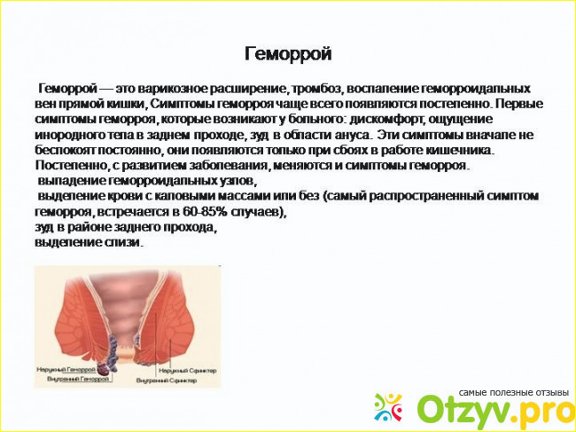 Отзыв о Чем лечить геморрой у женщин отзывы