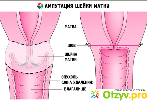 Беременность и роды