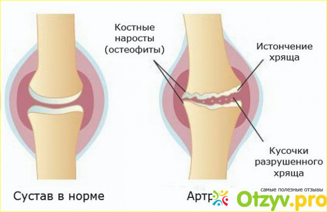 Способ применения: