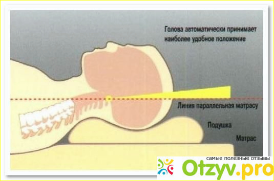 Ортопедические подушки отзывы какие лучше фото1