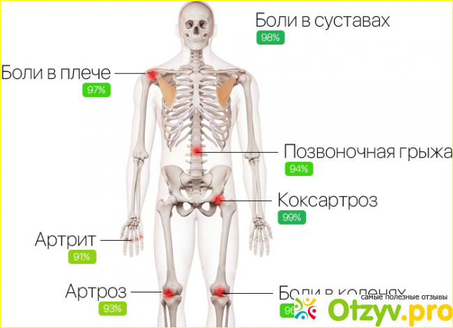 Аналоги и преимущества