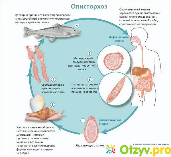 Описторхоз симптомы у человека и лечение отзывы