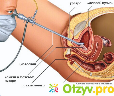 Как проводится процедура