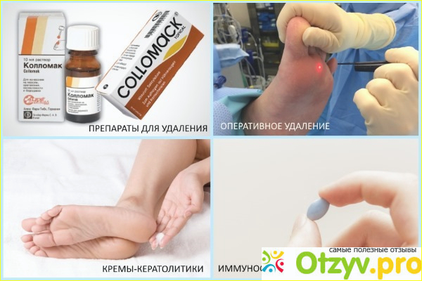 Отзыв о препарате Колломак