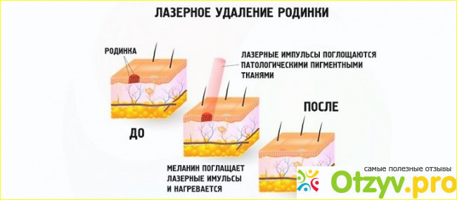 Довольно эффективная процедура