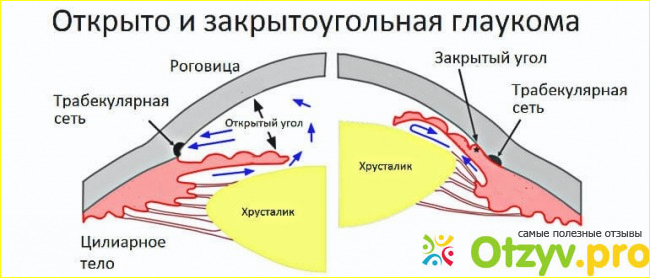 Отзыв о глазных каплях Трилактан