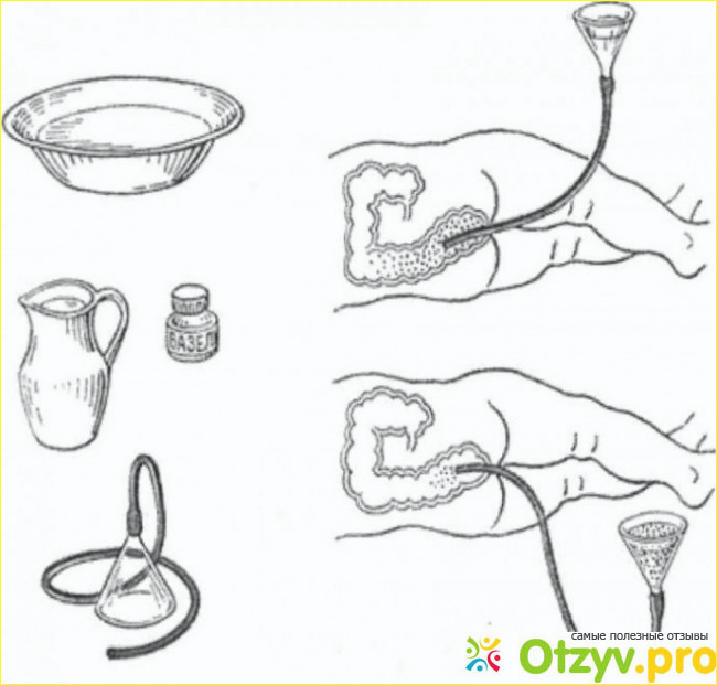 Отзыв о Клизмы для похудения в домашних условиях отзывы