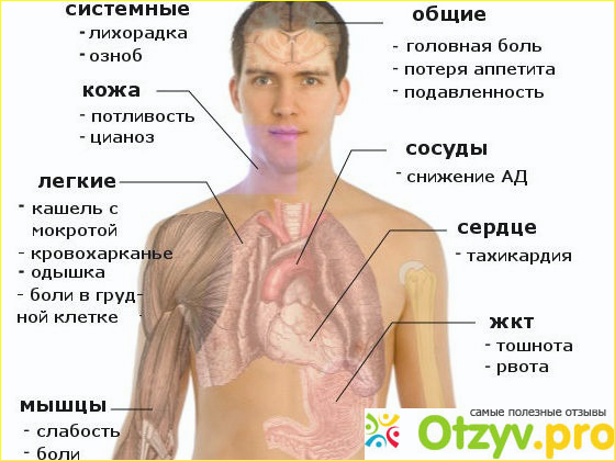 Пневмония - воспаление легких