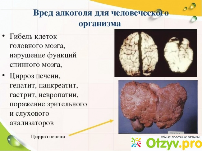 Какой вред организму. Вред алкоголя. Вред алкоголизма. Алкоголь вред для здоровья. Вред алкоголя на организм.