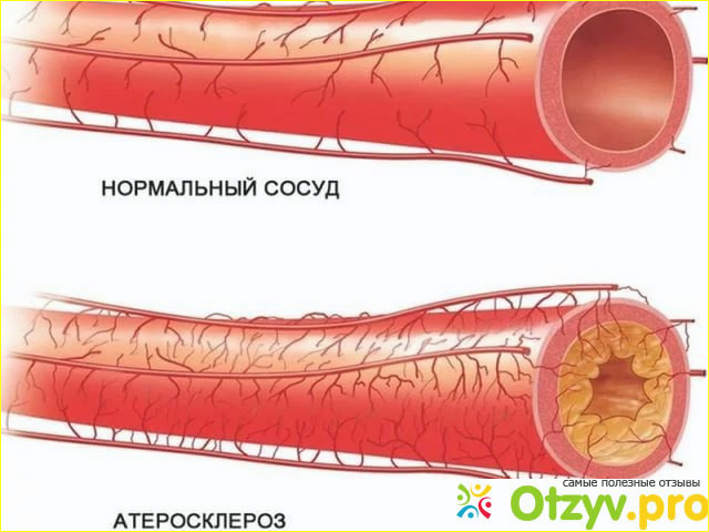 Отзыв о Липоевая кислота как принимать для похудения отзывы