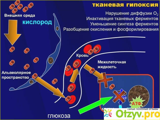 Другая причина гипоксии.