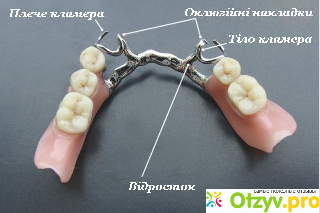 Альтернатива.