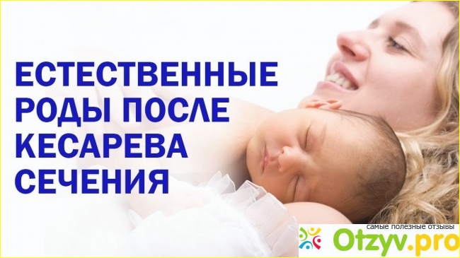 Отзыв о Естественные роды после кесарева сечения