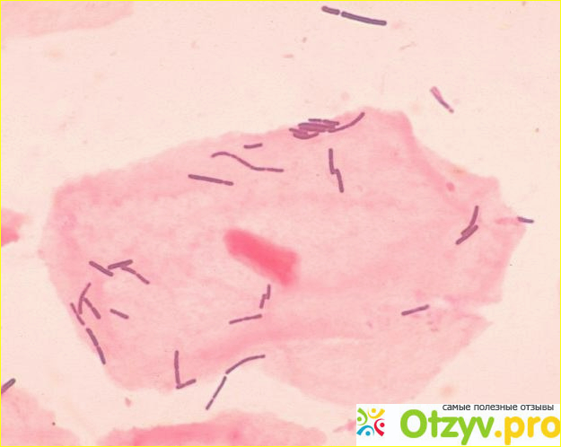 Lactobacillus spp: норма у женщин. Что такое Lactobacillus spp