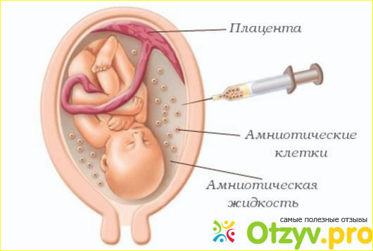 Зачем проводить процедуру