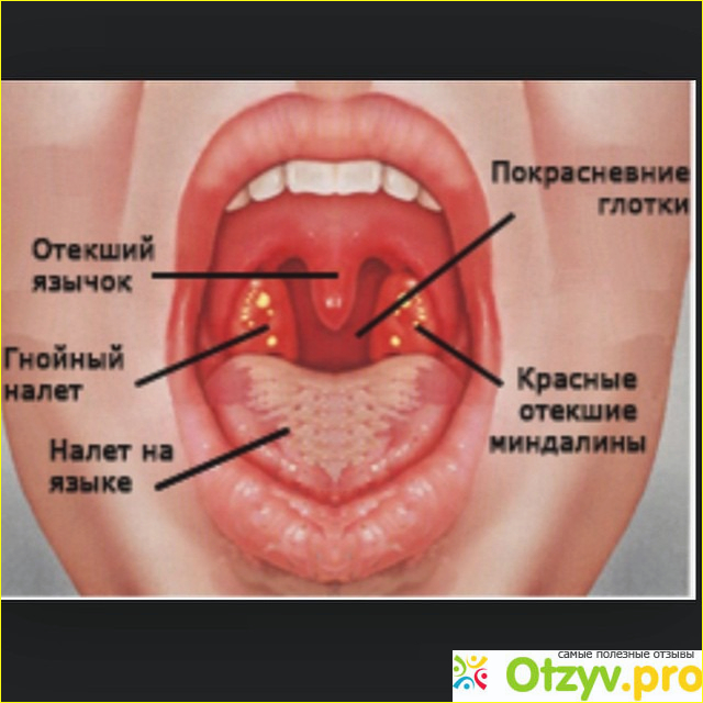 Если болезнь запустили