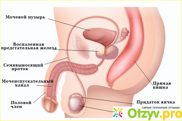 О чем говорит отсутствие утренней эрекции? 